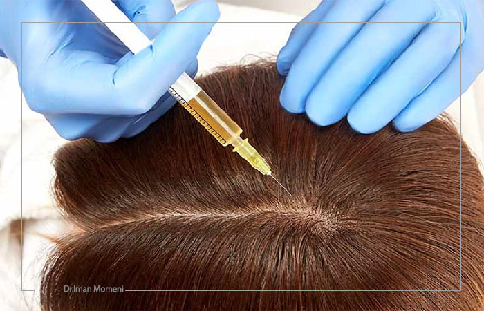 تزریق ویتامین به پوست سر